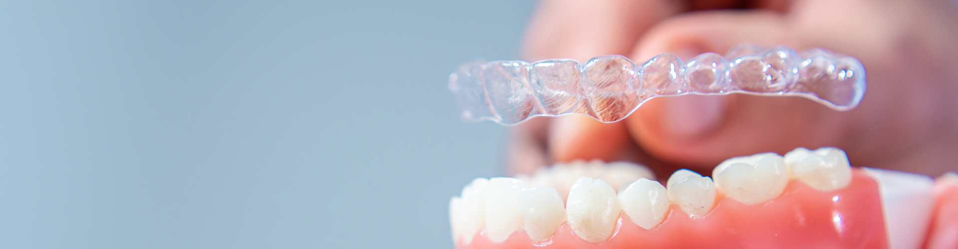 Hand holding clear aligner above jaw model.